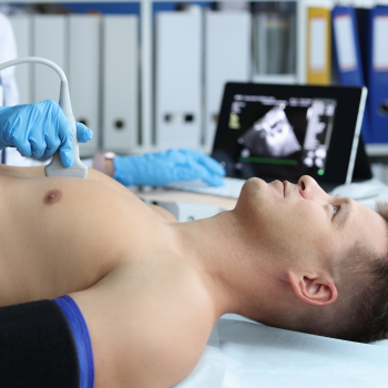 Echocardiogram