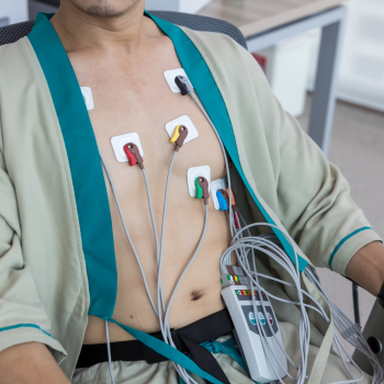 Holter Monitoring