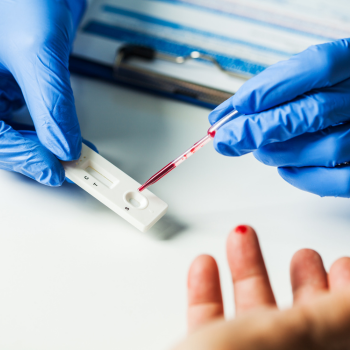 Serology